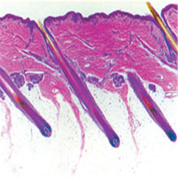 人皮膚切片（示毛囊）